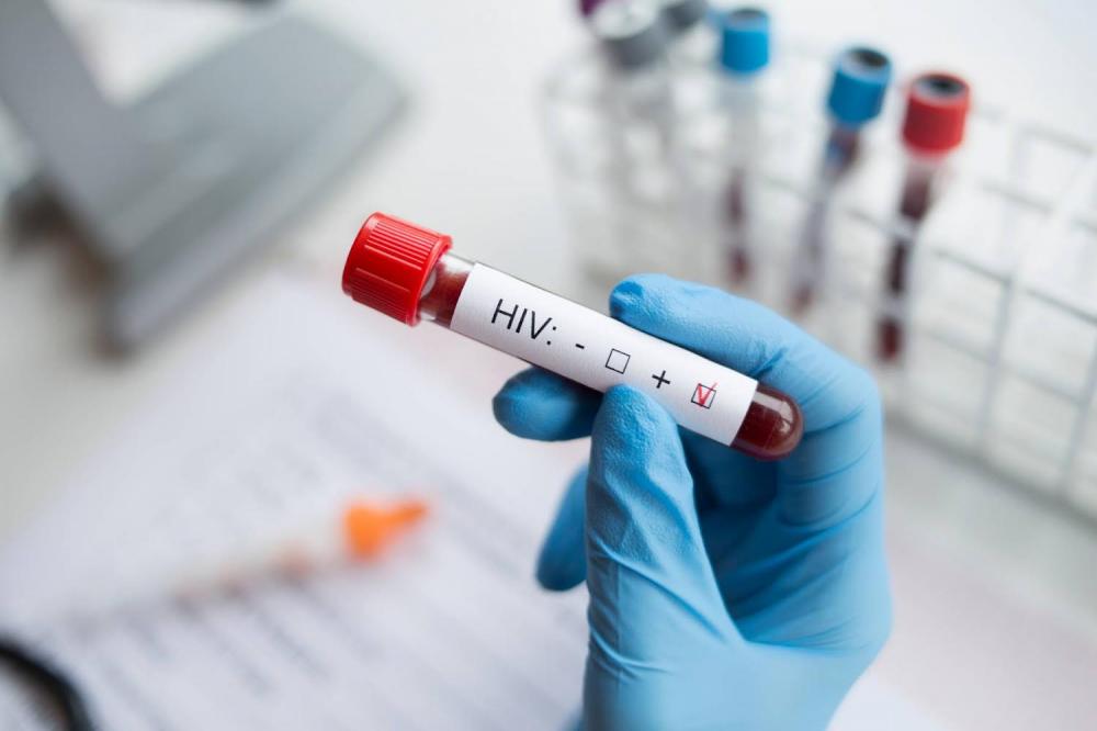 Dia Mundial de Combate à AIDS: mais de 2.304 casos de HIV são registrados na Bahia